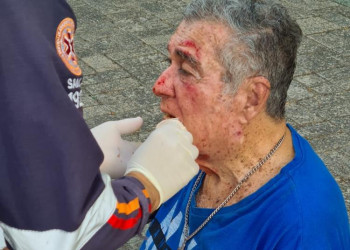 Ex-deputado João Silva sofre acidente durante caminhada em Teresina
